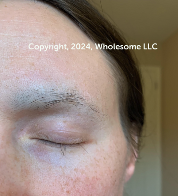 Alison Tierney of Wholesome LLC shares the stage of her eyebrows and eyelashes 7 weeks post her last chemotherapy session. Copyright, 2024, Wholesome LLC